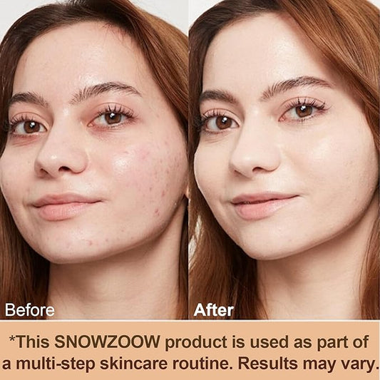 Color Changing Medium/Light 4 in 1 Hydrating full coverage concealer Foundation makeup Liquid-Longwearing & Waterproof- with SPF 50