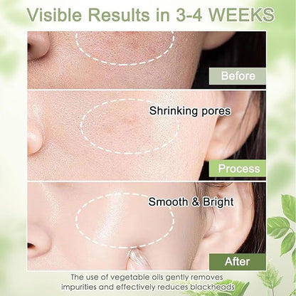 COSMOO Deep Cleansing Oil, Pore Control Oil Cleanser for Face, Makeup Blackhead Remover, Korean Skin Care, All Skin Types - 200ml ×2