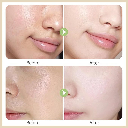 Erinde Red Correct CC Cream with Centella, Lightweight CC Cream Foundation for Mature Skin Women, Color Correcting Cream, Medium Coverage CC Cream Foundation, Natural Finish