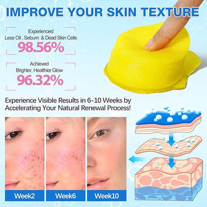 Turmeric Cleansing Pads Kojic Acid Turmeric Cleansing Pads, Face Turmeric & Kojic Acid Pads for Dark Spots, Glow Up Acne Scars, Unclog Pores, Enriched Vitamin C,Gentle & Non-Irritating