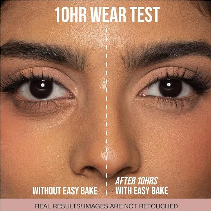 H.U.D.A BEAUTY Easy Bake Loose Baking & Setting Powder Cupcake (0.71 oz / 20 g) + Bonus Acne Patch (36 Pieces)