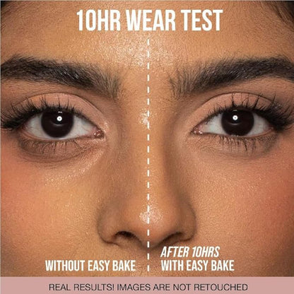 H.U.D.A BEAUTY Easy Bake Loose Baking & Setting Powder Cupcake (0.71 oz / 20 g) + Bonus Acne Patch (36 Pieces)
