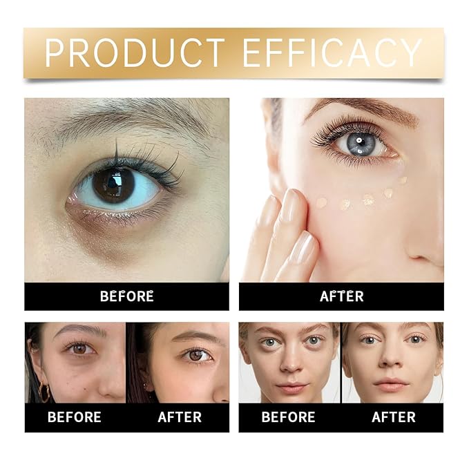 Dark Circle Concealer Cream – Lightweight, Hydrating Eye Concealer for Daily Use, Moisturizing, Brightening and Covering Under-Eye Circles (Natural)