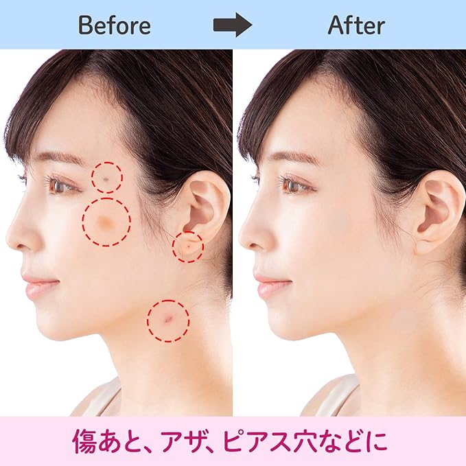 [CLASSE]Seal Concealer, Cover Up tape, Made in Japan, ultra-thin 0.015mm, different sizes, natural coverage, Waterproof,Sweatproof, for Hiding Tattoo and Scars,(B20 Honey, Round shape, 8 pieces)