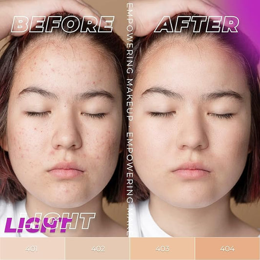 Oh My Clear Face Full Coverage Foundation for Oily & Acne Prone Skin, Salicylic Acid & Tea Tree Extract, Anti-Blemish Sensitive Skin Care, Organic & Oil-Free, 403 Neutral, 40 ml / 1.35 fl.oz