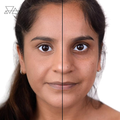 Loves-You-Back 3in1 Mineral Powder Foundation (BEIGE 4) | Designed for acne-prone, sensitive skin | Smooths skin and covers dark circles with Natural Coverage | Vegan + Cruelty Free