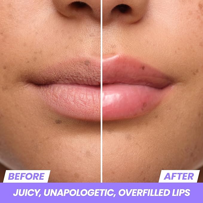 Wonderskin Lip Relapse Plumping Gloss – Lip Plumper Gloss for Fuller-Looking Lips with Hydrating, Non-Sticky, High-Shine Finish