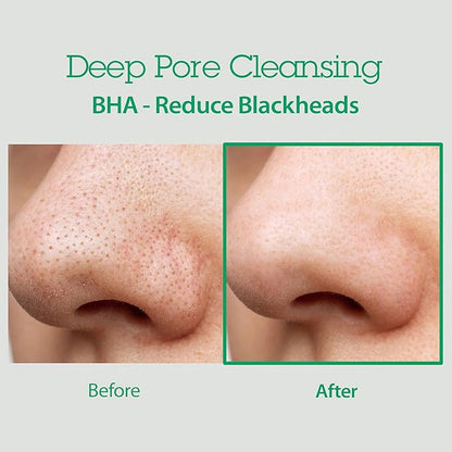 BLITHE Pore Care Duo – Cleansing Balm & AHA BHA Cleanser | Deep Pore Cleansing, Makeup Remover, Gentle Exfoliation & Hydration | Korean Skincare for Clear, Smooth Skin