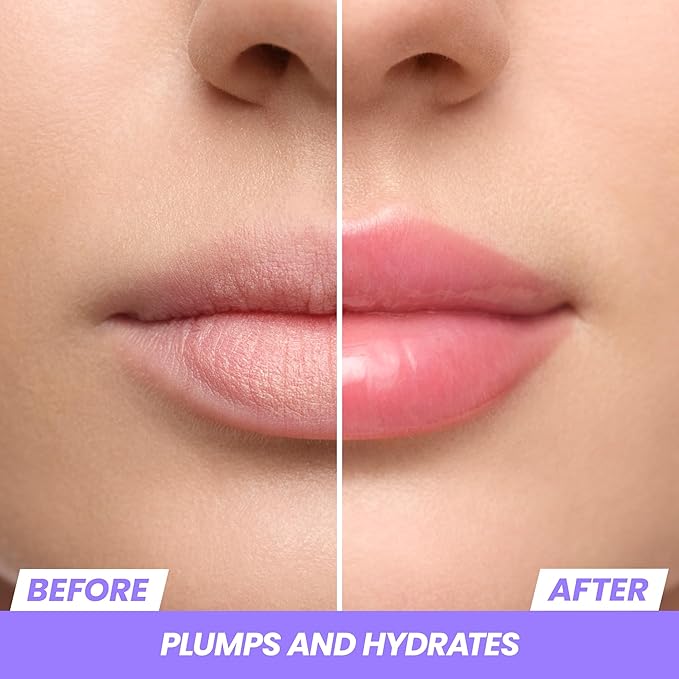 Wonderskin Lip Relapse Plumping Gloss – Lip Plumper Gloss for Fuller-Looking Lips with Hydrating, Non-Sticky, High-Shine Finish