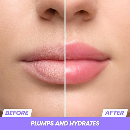 Wonderskin Lip Relapse Plumping Gloss – Lip Plumper Gloss for Fuller-Looking Lips with Hydrating, Non-Sticky, High-Shine Finish