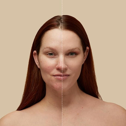 Sigma Beauty Skin Perfector – Hydrating Skin Tint Foundation for Lightweight, Buildable Coverage, With Hyaluronic Acid, Niacinamide Serum, and More (2 Light Beige Tint, 1.12oz)