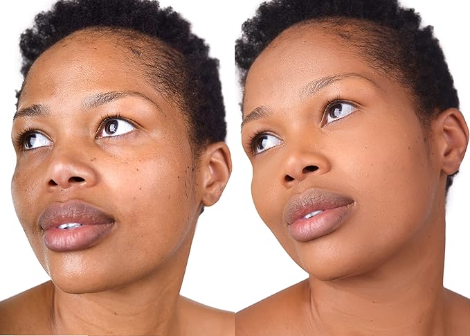 Loves-You-Back 3in1 Mineral Powder Foundation (CARAMEL 2) | Designed for acne-prone, sensitive skin | 3IN1 - Concealer, Foundation + Powder | No skin agitation with calming Zinc Oxide