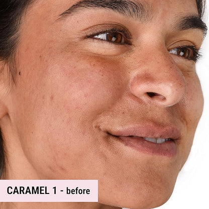 Loves-You-Back 3in1 Mineral Powder Foundation (CARAMEL 1) | Designed for acne-prone, sensitive skin reducing the appearance of acne and scars without layers | Vegan + Cruelty Free