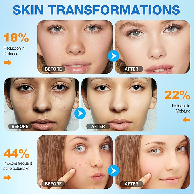 Turmeric Cleansing Pads Kojic Acid Turmeric Cleansing Pads, Face Turmeric & Kojic Acid Pads for Dark Spots, Glow Up Acne Scars, Unclog Pores, Enriched Vitamin C,Gentle & Non-Irritating