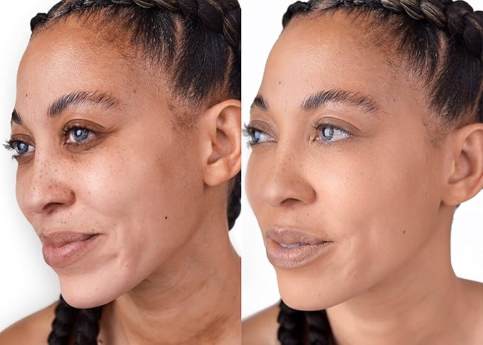 Loves-You-Back 3in1 Mineral Powder Foundation (CARAMEL 1) | Designed for acne-prone, sensitive skin reducing the appearance of acne and scars without layers | Vegan + Cruelty Free