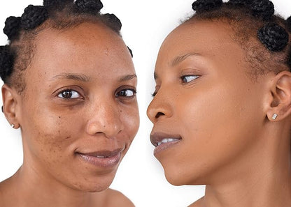 Loves-You-Back 3in1 Mineral Powder Foundation (CARAMEL 2) | Designed for acne-prone, sensitive skin | 3IN1 - Concealer, Foundation + Powder | No skin agitation with calming Zinc Oxide