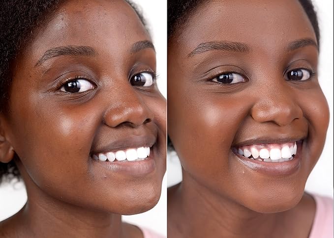 Loves-You-Back 3in1 Mineral Powder Foundation (COCO 1) | Designed for acne-prone, sensitive skin | 3IN1 - Concealer, Foundation + Powder | Evens skin tone | Natural + Lightweight