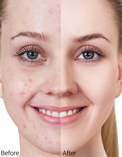 Erinde Color Changing Foundation Makeup, Liquid Foundation Moisturizing BB Cream Makeup Base, Improves Uneven Skin Tone, Blendable, Lightweight, Medium Coverage, Vegan & Cruelty-Free, 1 Fl Oz