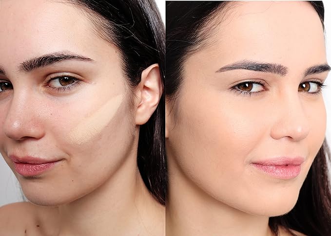 Loves-You-Back 3in1 Mineral Powder Foundation (BEIGE 2) | Designed for Rosacea, Acne-Prone, Sensitive Skin | 3IN1 - Concealer, Powder and Foundation | Natural + Lightweight Coverage