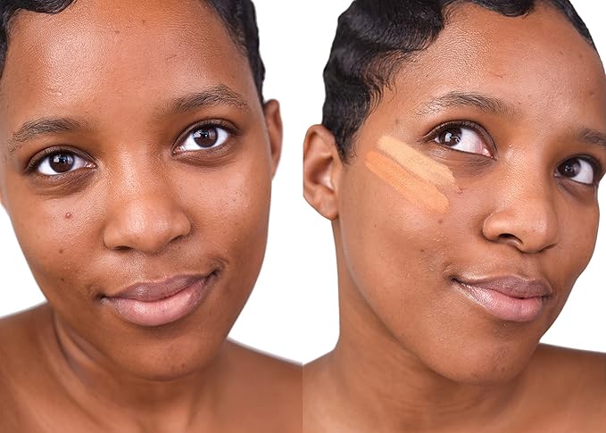 Loves-You-Back 3in1 Mineral Powder Foundation (CARAMEL 3) | Designed for acne-prone, sensitive skin for Natural Coverage with calming Zinc Oxide + Kaolin Clay | Vegan + Cruelty Free