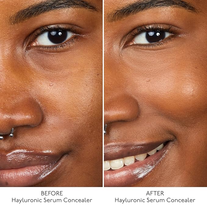 By Terry Hyaluronic Serum Concealer, Radiant & Hydrating Skincare-Infused Concealer, Buildable Coverage, Vegan, Deep Tan
